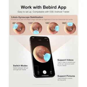 Bebird R1 Ear Wax Removal Tool with Ear Camera