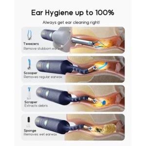 Bebird i35R Ear Cleaning Camera Wax Removal Tool kit