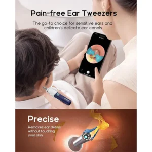 Bebird i35R Ear Cleaning Camera Wax Removal Tool kit