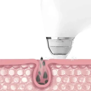 Xiaomi DOCO Ultra-micro Bubble Pore Vacuum Cleaner Blackhead Remover
